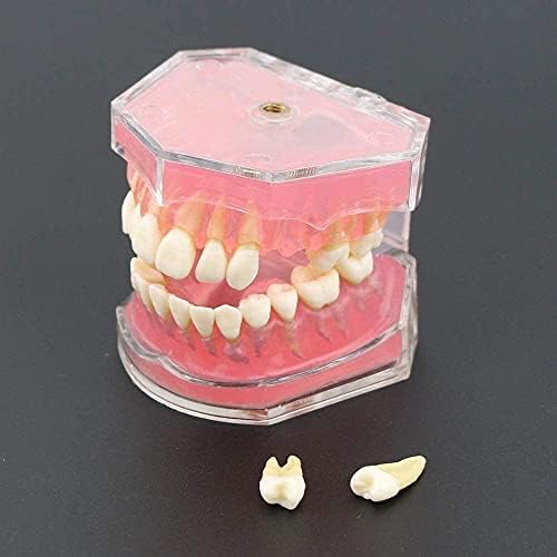 Wzqwzj Модел на човешки орган LMEILI Стоматологичен Стандартен модел с Подвижни зъби Стоматологично Изследване